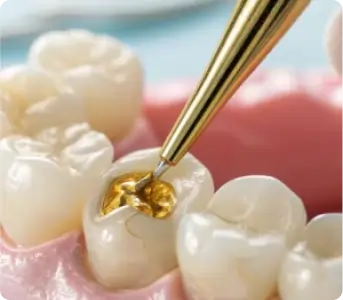 Fillings