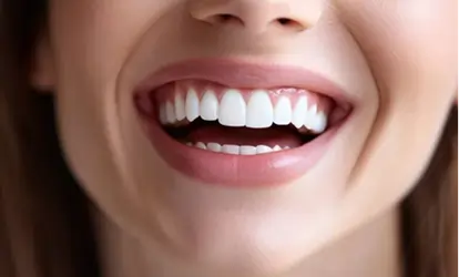 Teeth Cleanings