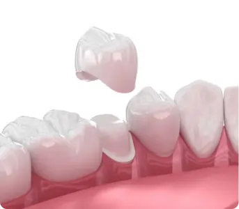 Crowns