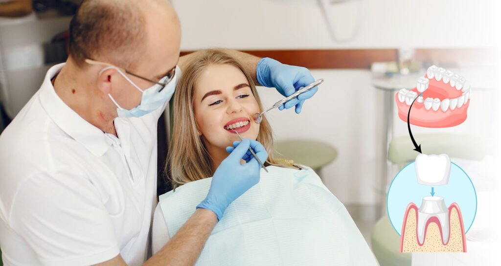 How to Replace a Dental Crown Complete Guide