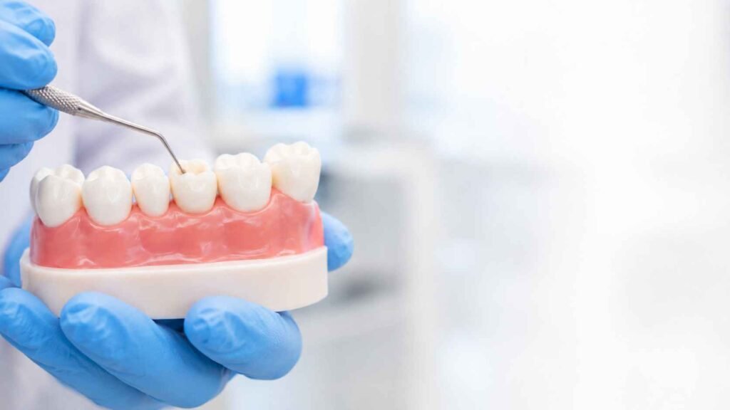 Early Cavity Detection