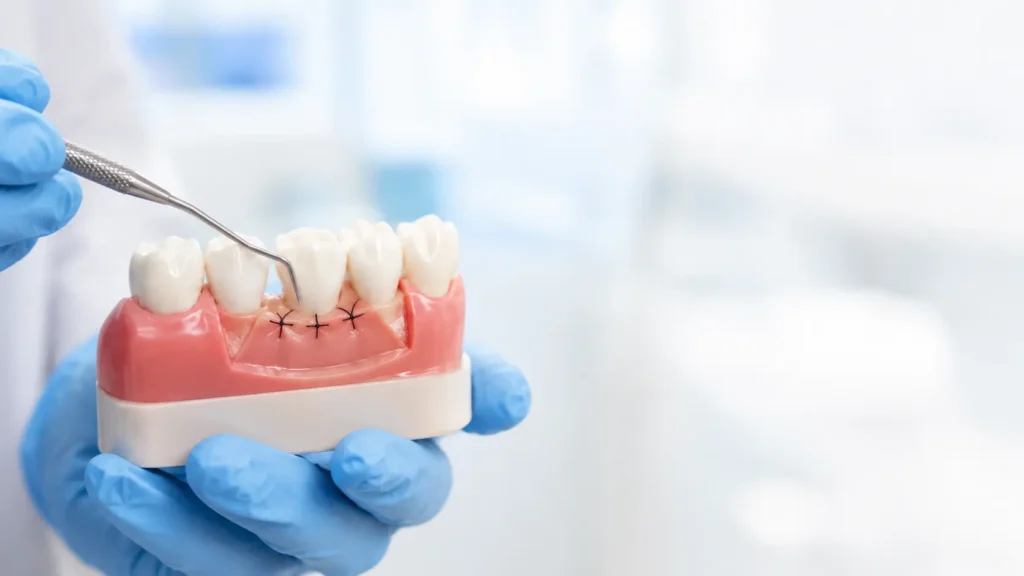 Gum Surgery