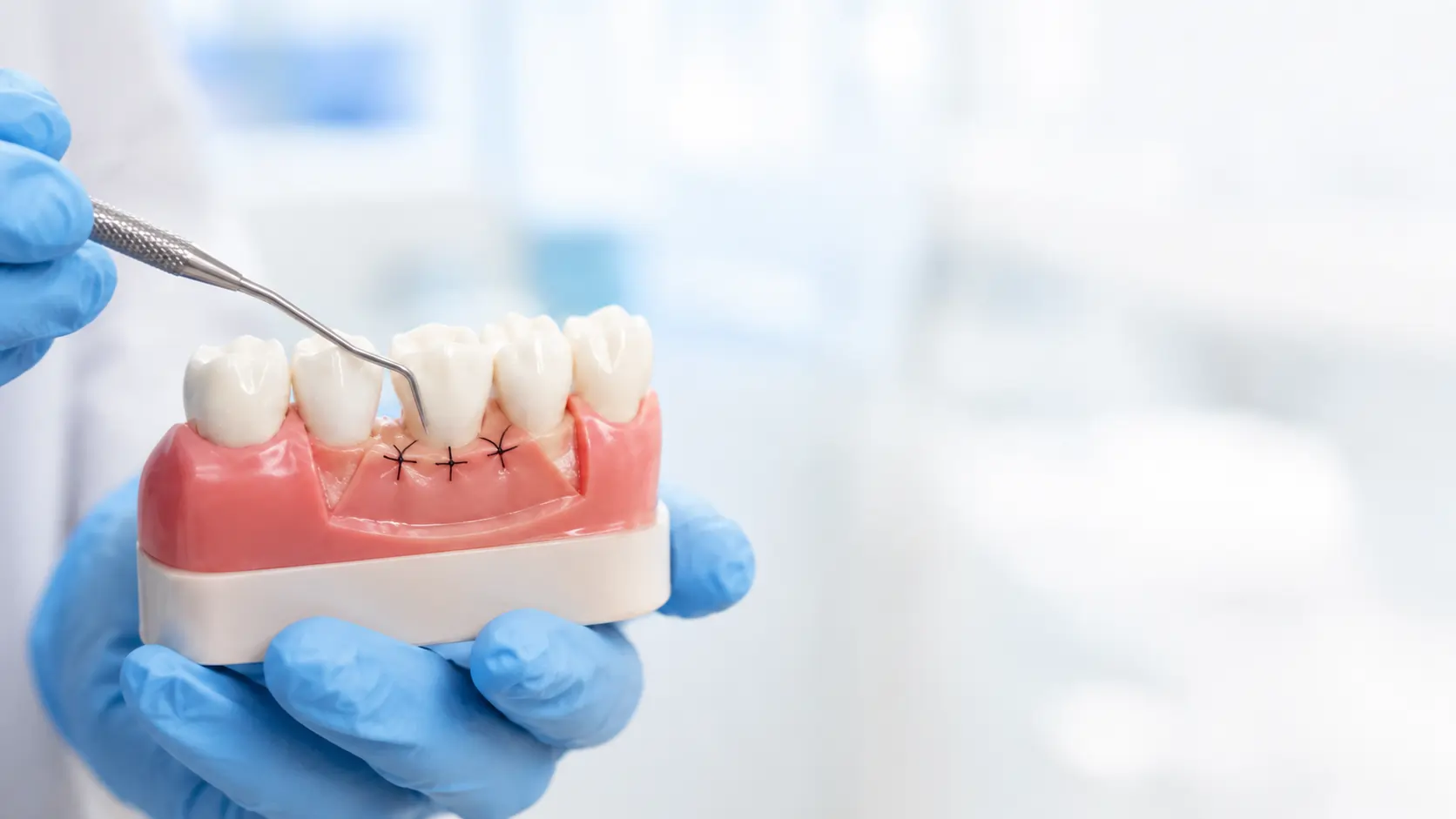 Gum Disease